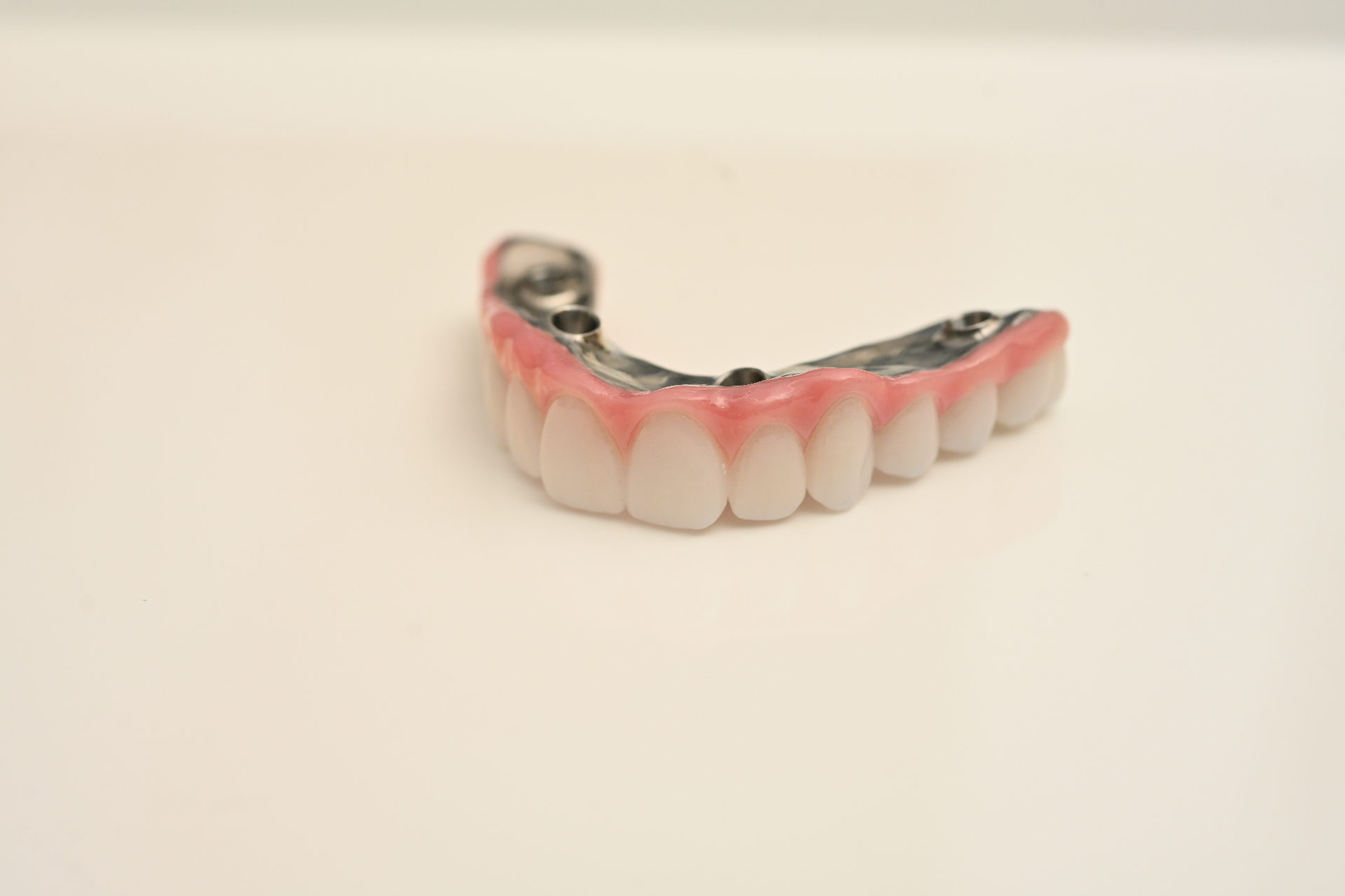 Dental implant arch prosthetic with titanium bar